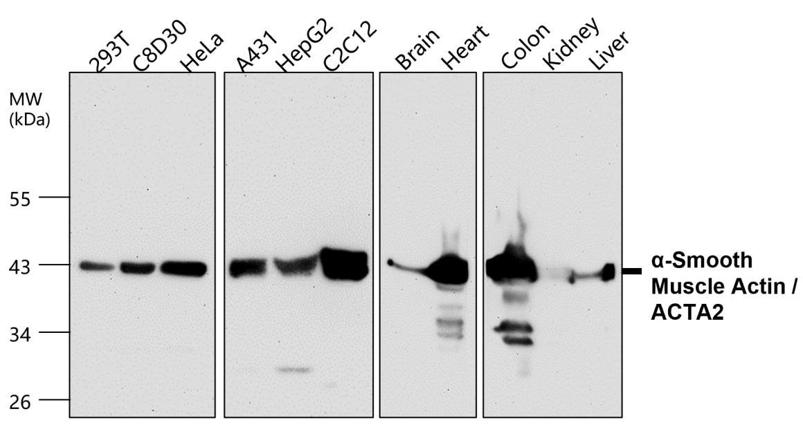 α-Smooth Muscle Actin Antibody