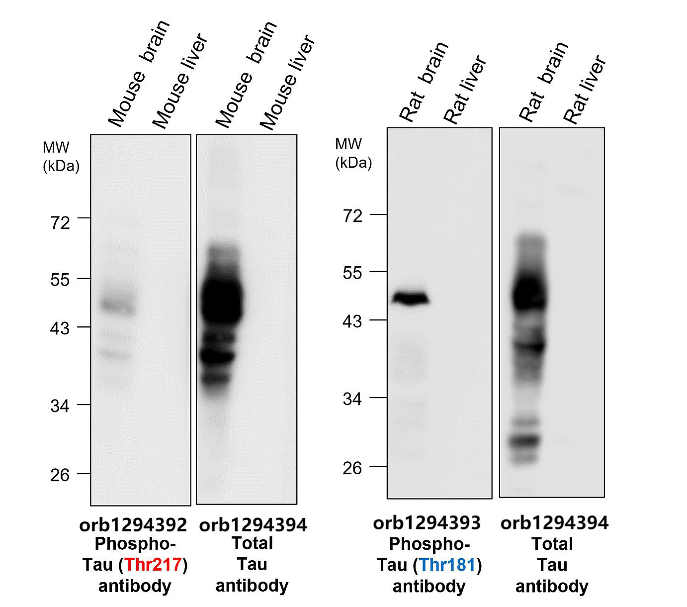 Tau (Phospho-Thr217) antibody
