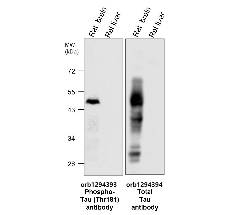 Tau (Phospho-Thr181) antibody