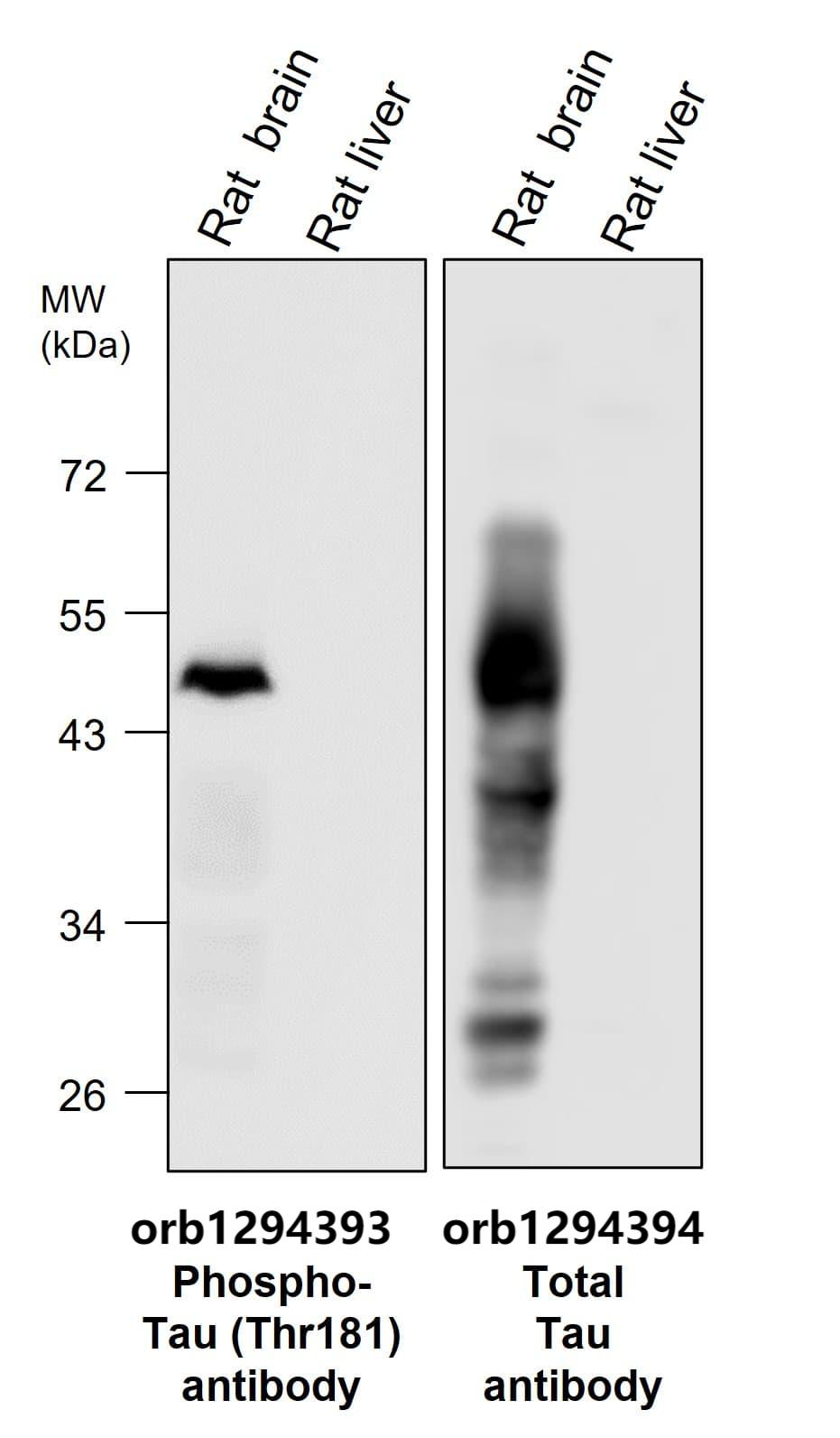 Tau Antibody