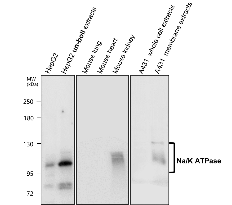 NaK ATPase alpha 1 / ATP1A1