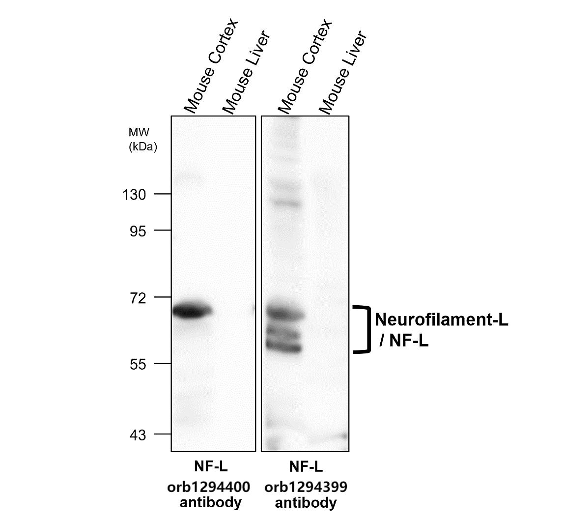 Neurofilament L antibody