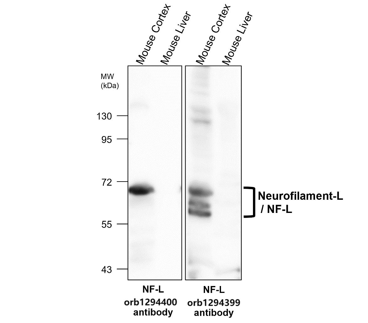 Neurofilament L antibody