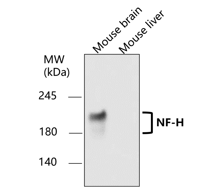 Neurofilament H antibody