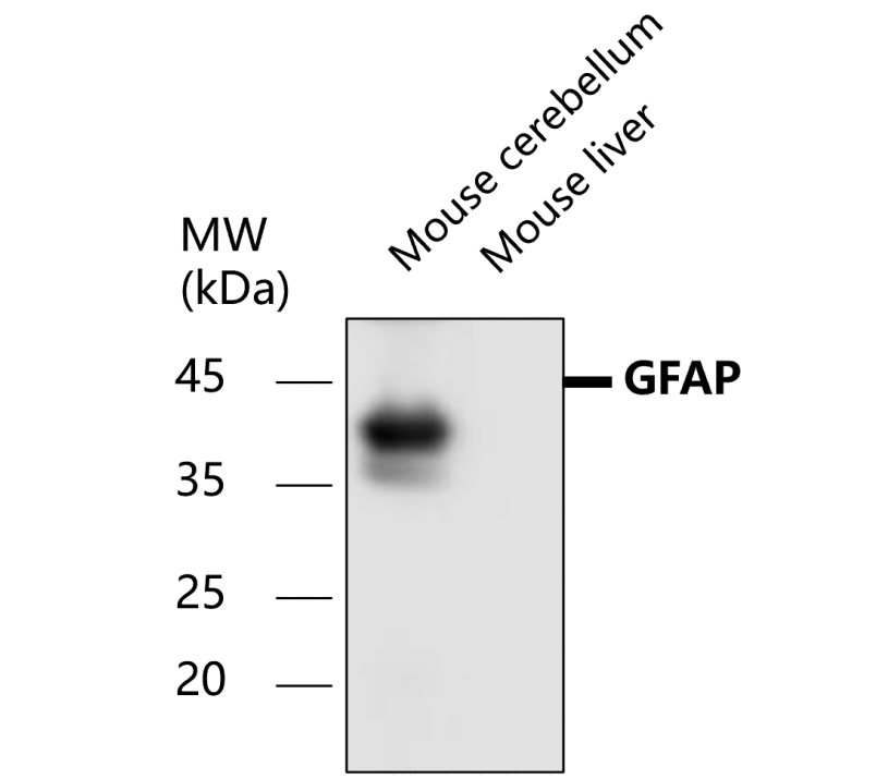 GFAP Antibody