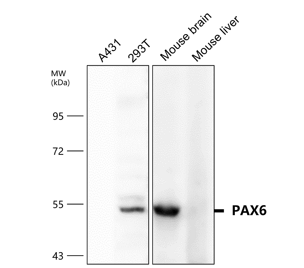 PAX6