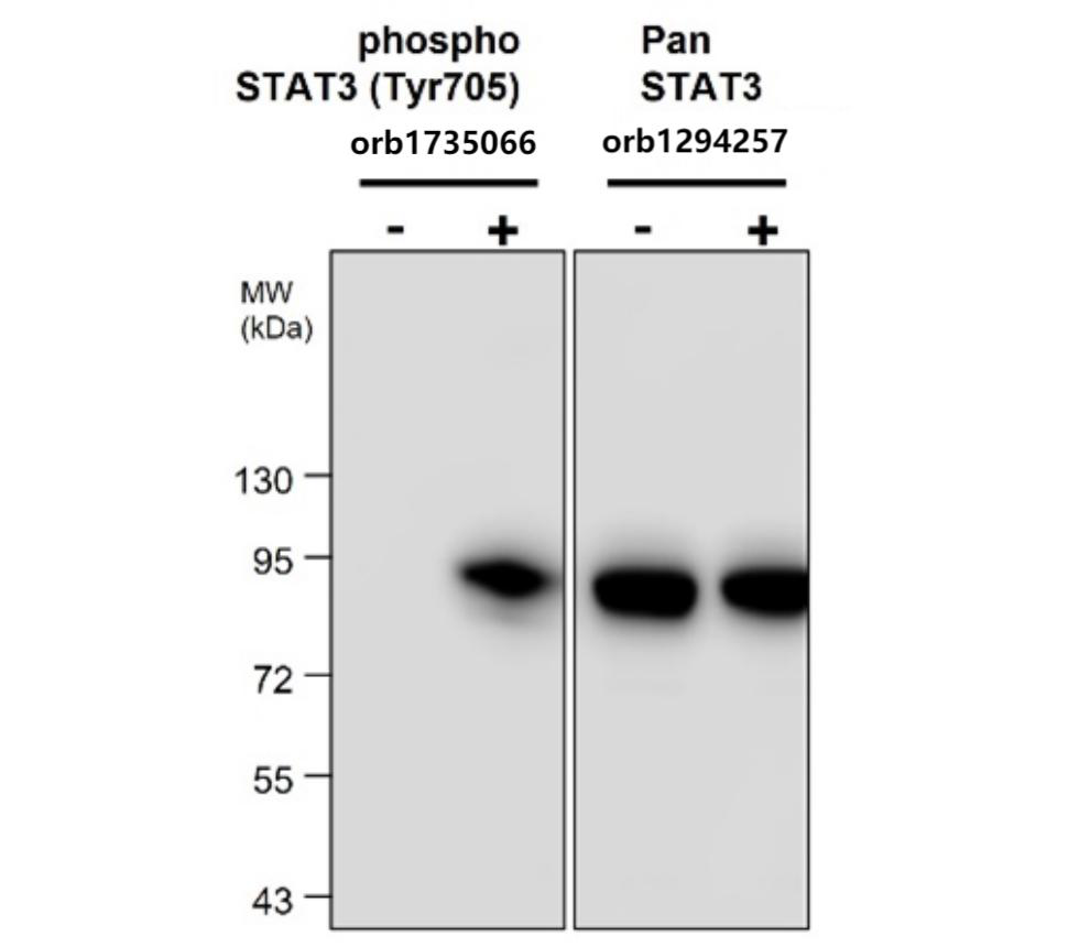STAT3 Phospho (Tyr705) Antibody