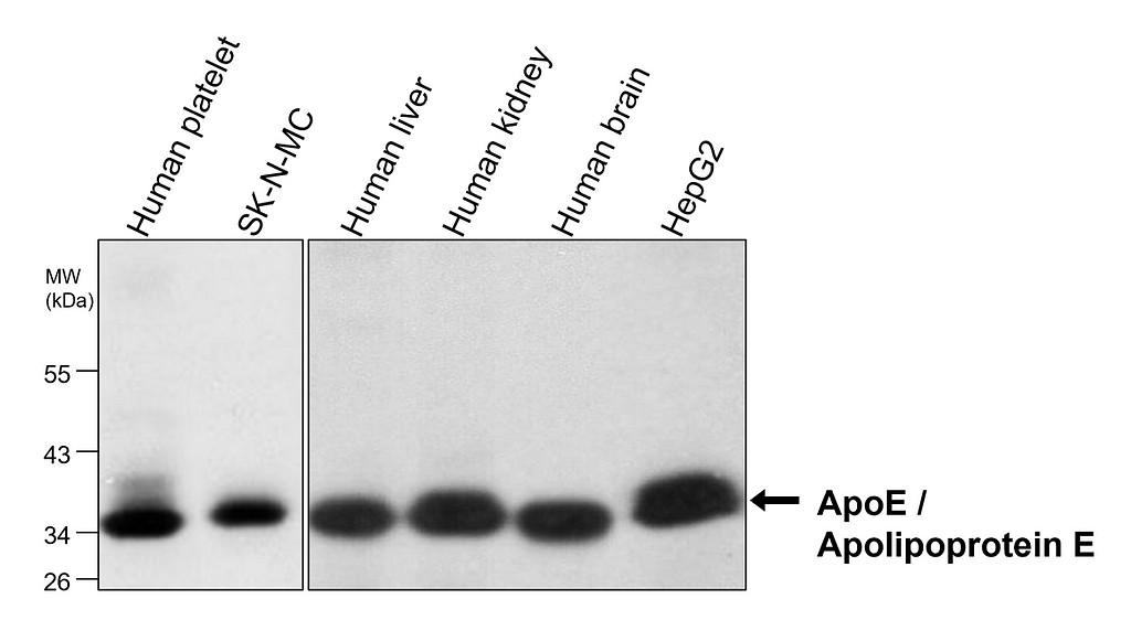 ApoE / Apolipoprotein E antibody