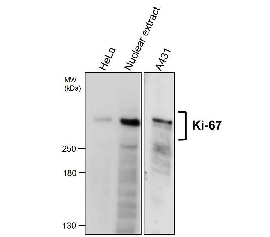 KI-67 Antibody
