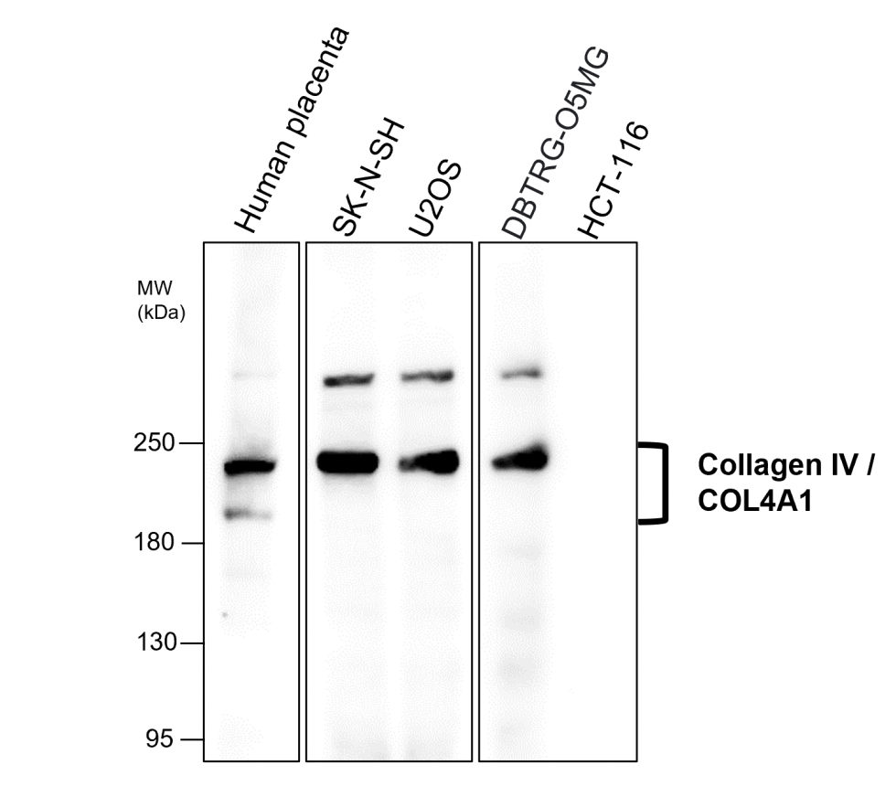 Collagen IV /COL4A1 Antibody