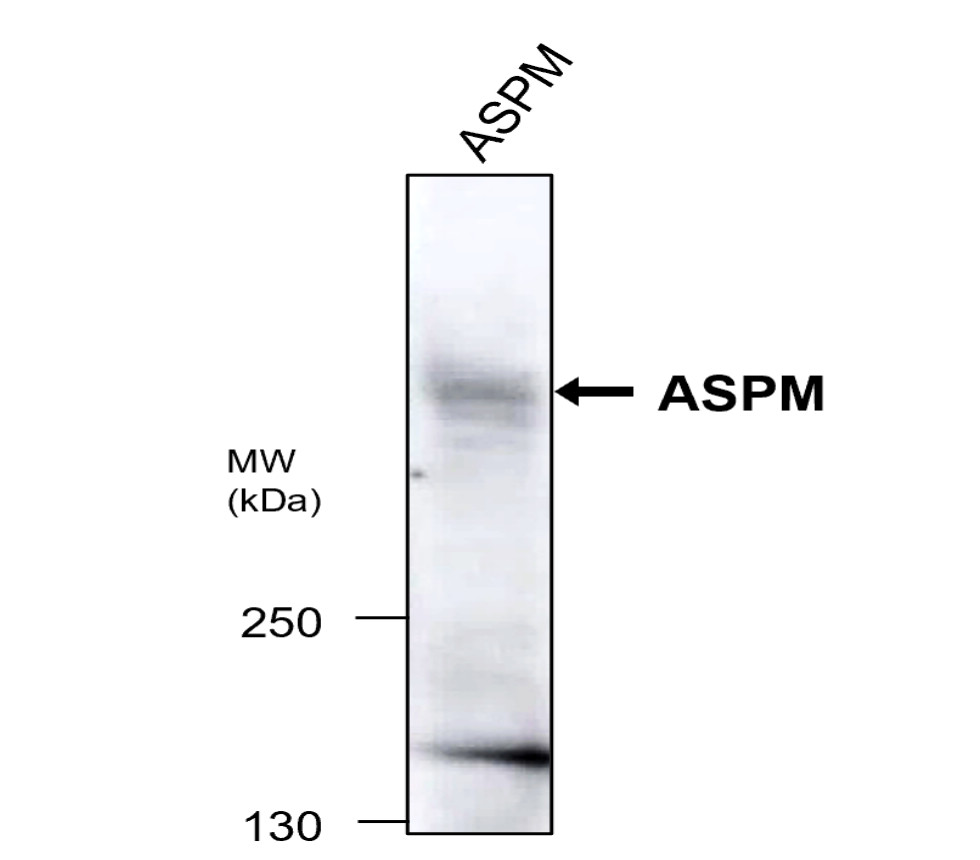 ASPM (isoform1 specific) Antibody