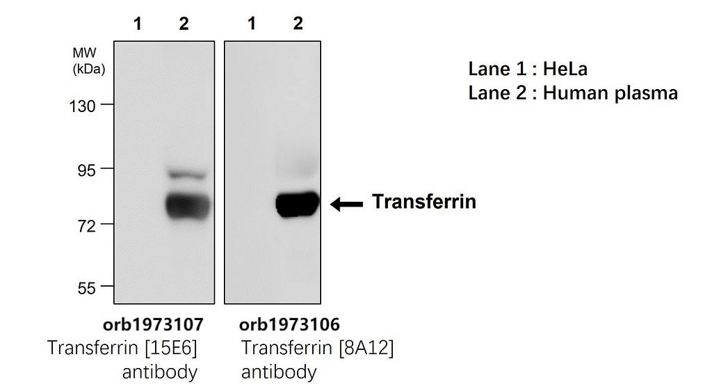 Transferrin / TF antibody [8A12]