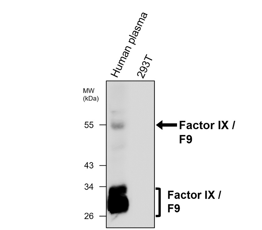Factor IX / F9 antibody [PB-3]