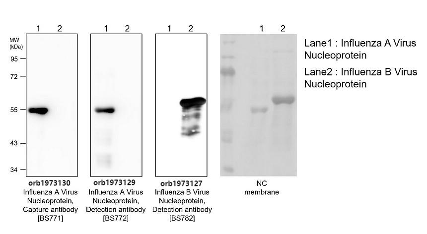 Influenza B Virus Nucleoprotein, Detection antibody [BS782]