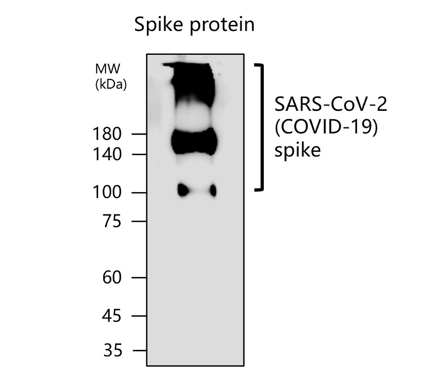 SARS-CoV-2 (COVID-19) Spike Protein S1-NTD Antibody