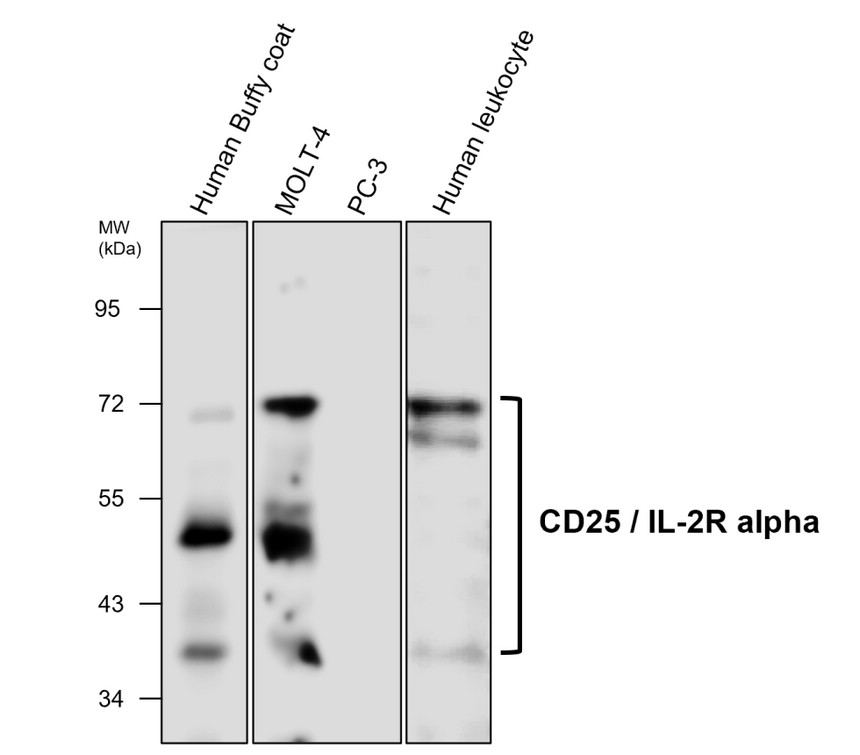 CD25 / IL-2R alpha antibody [M431]