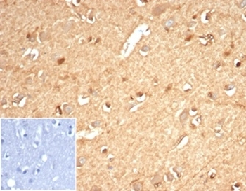 AKR1B1 Antibody / Aldose reductase