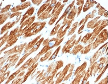 Desmin Antibody