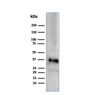 Clusterin Antibody / Apolipoprotein J / APO-J