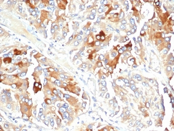 Clusterin Antibody / Apolipoprotein J / APO-J