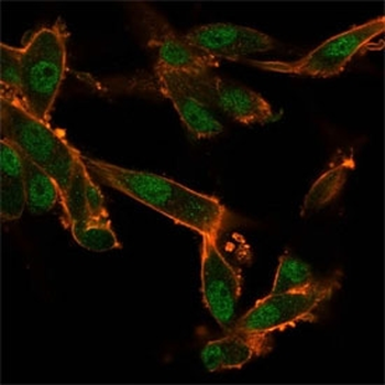 CELF2 Antibody / CUGBP2 / ETR3