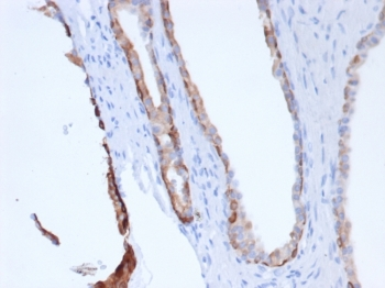 Pan Cytokeratin Antibody Cocktail