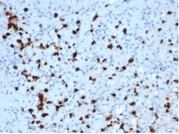 MPO Antibody / Myeloperoxidase