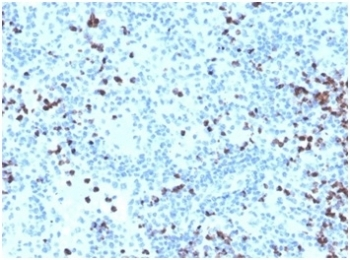 MPO Antibody / Myeloperoxidase