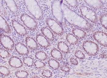 MLH1 Antibody / MutL Homolog 1