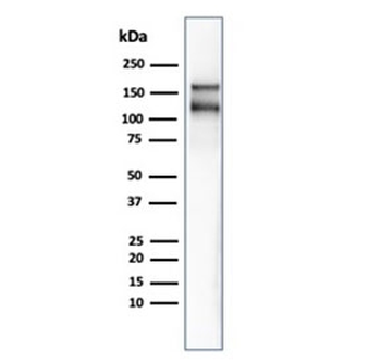 MSH6 Antibody