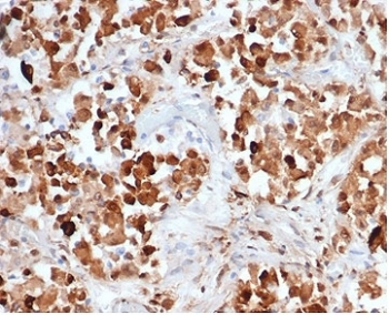 Growth Hormone Antibody / GH1