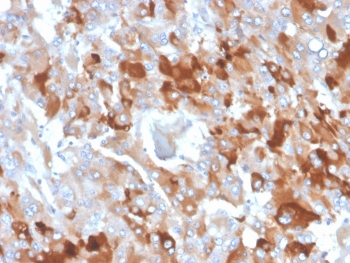 Clusterin Antibody / Apolipoprotein J / APO-J
