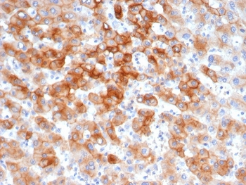 KRT8 Antibody / Cytokeratin 8