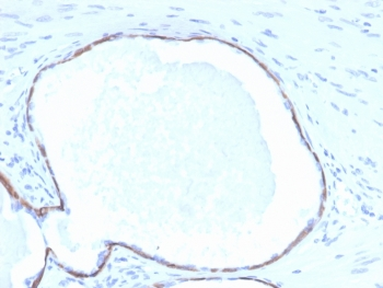 Cytokeratin 14 Antibody / CK14 / KRT14