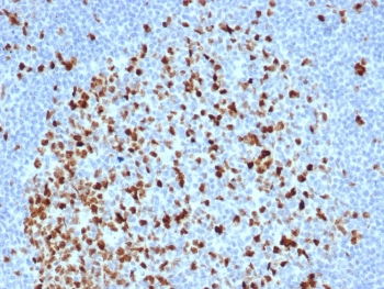 Topoisomerase II alpha Antibody / TOP2A