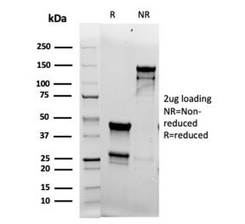 Topoisomerase II alpha Antibody / TOP2A