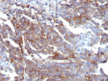 CD44 Antibody / HCAM