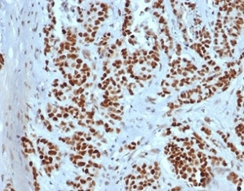 MSH2 Antibody