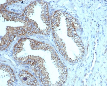 TMEPAI Antibody / PMEPA1