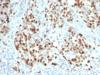 Ki-67 Antibody