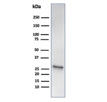 HSP27 Antibody / HSPB1