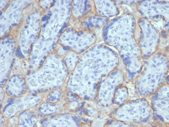 EGF Receptor / EGFR Antibody (Extracellular domain)