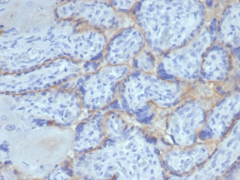 EGF Receptor / EGFR Antibody (Extracellular domain)