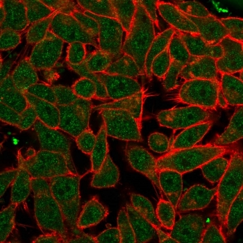 PDX1 Antibody / Pancreas/duodenum homeobox protein 1