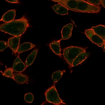 ZBTB39 Antibody / ZNF922 / KIAA0352