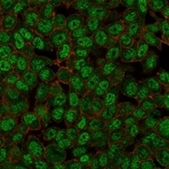 ZMYM3 Antibody