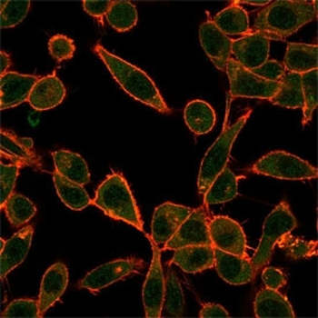 Ubiquitin-protein ligase E3A Antibody / UBE3A