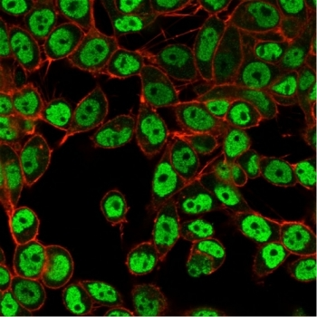 SMARCC1 Antibody / BAF155