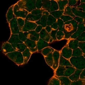PRMT6 Antibody