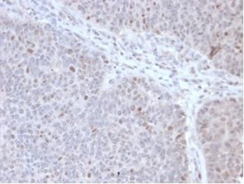 POLE3 Antibody / CHRAC-17